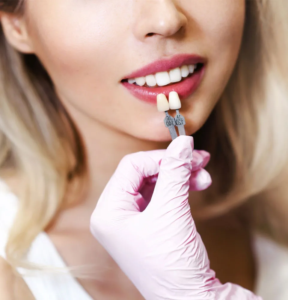 Türkiye Zirkonyum Diş Kaplama - 2Gün