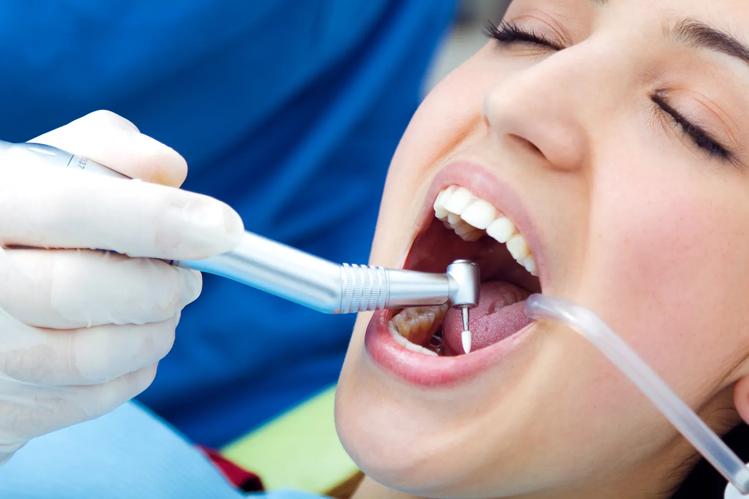 Kapadokya Kanal Tedavisi - Endodonti 5Gün
